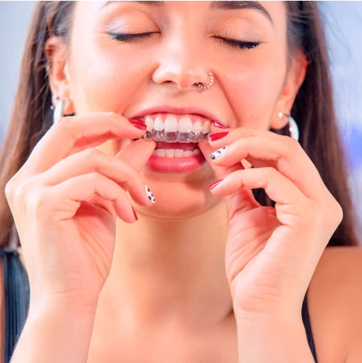 Tipos de alineadores invisibles en México