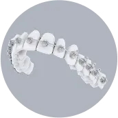 Brackets tradicionales